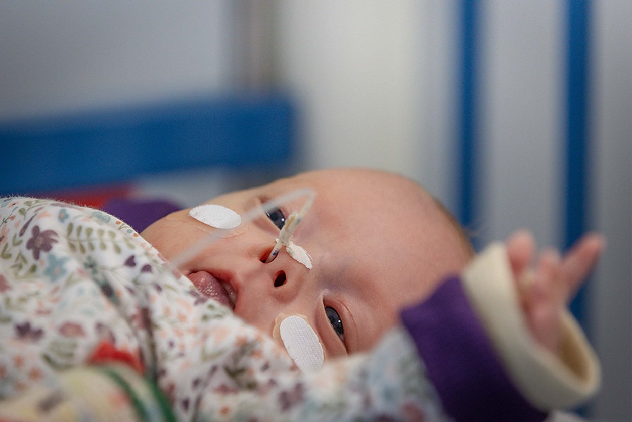 Das kleine Frühchen macht Fortschritte und wird Rund-um-die Uhr im Perinatalzentrum Rosenheim professionell versorgt.